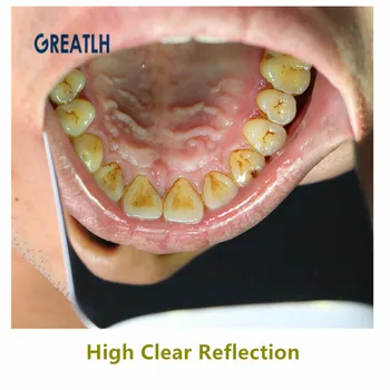 Dantų Automatinė Anti-rūko Veidrodžiai žodžiu fotografijos Reflektorius, Stiklas Defog veidrodėliai Ortodontinis už Burnos okliuzijos Kalbomis