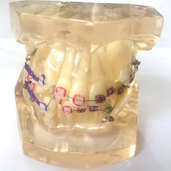 Ortodontinis Medžiagos, Dantų Lankai Super Elastinga Ni-Ti Laidų 10 Maišeliai 100 Vnt Odontologo Klinika, Ligoninės Laboratorijoje Įrankiai Danties Modelis